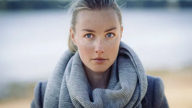 3 produk alami hilangkan flek hitam pada wajah