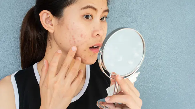 Wajah Gampang Memerah dan Perih? Jangan Diabaikan, Ini Tanda Skin Barrier Kamu Sedang Bermasalah