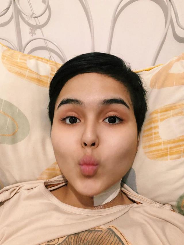 6 Potret Perjuangan Laura Anna Hadapi Spinal Cord Injury, Fisioterapis Hingga Akupuntur