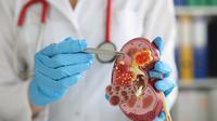Ilustrasi organ ginjal (Shutterstock/H_Ko)