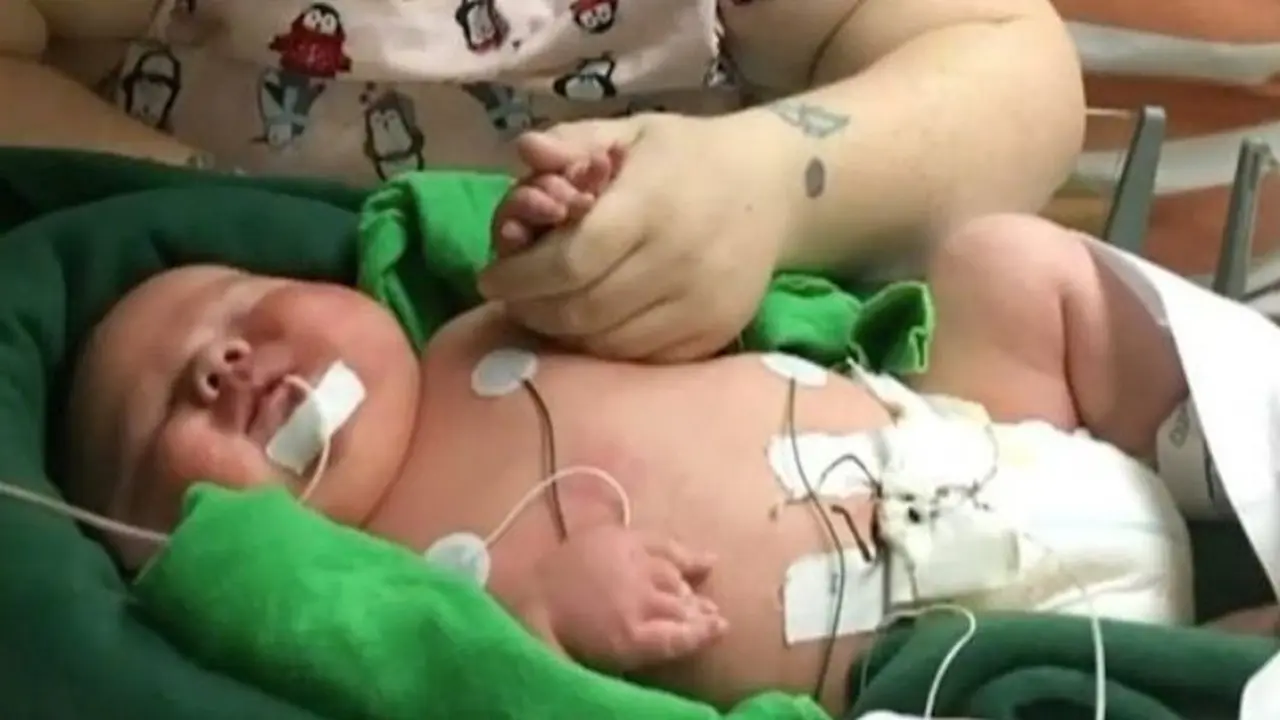 Pecahkan Rekor, Bayi Terbesar Ini Beratnya 6,4 Kg Saat Dilahirkan