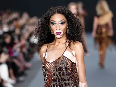 Model bernama Winnie Harlow menampilkan koleksi Spring/Summer 2018 untuk L'Oreal di Paris Fashion Week, Minggu (1/10). Namanya mencuat seiring dengan tertariknya orang memandang kulitnya yang bercorak putih. (AP Photo/Kamil Zihnioglu)