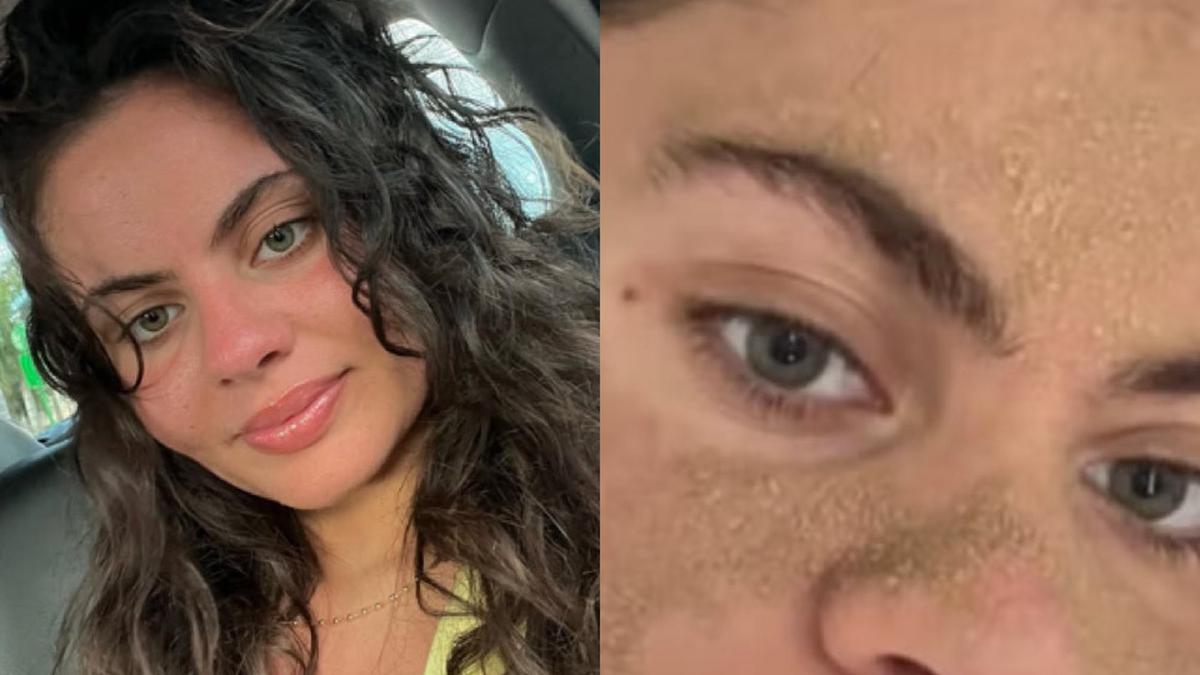 Viral Caveman Method Seorang Wanita Perlihatkan Wajah Tidak Tak Cuci Muka Selama 7 Minggu, Dokter Ungkap Risiko Kesehatan Kulit
