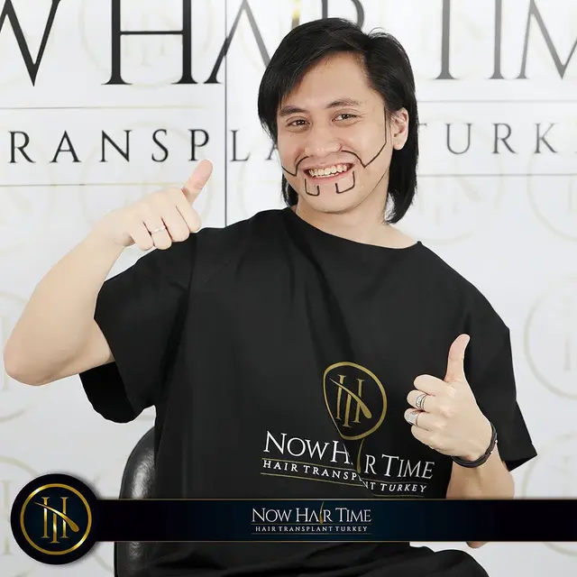 5 Potret Terbaru Kevin Aprilio Usai Transplantasi Rambut, Bikin Pangling