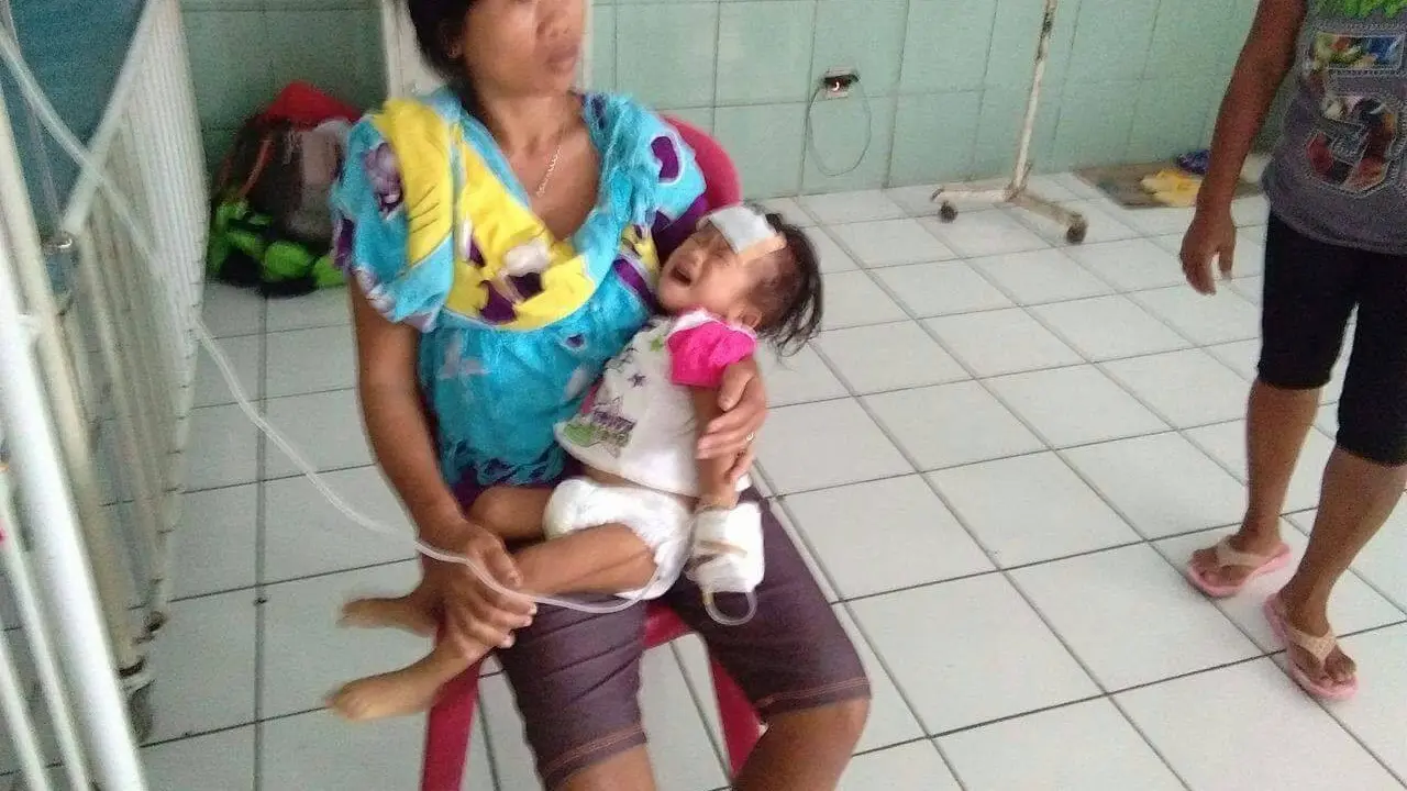 Kisah Malang Jessica Balita Pengidap Gizi Buruk