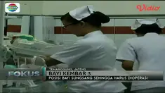 Di Temanggung, Jawa Tengah, lahir bayi kembar tiga dengan kondisi sehat. Bagaimana ceritanya? 