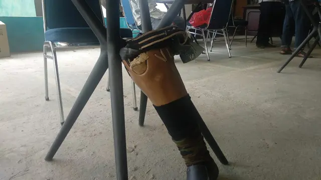 kaki palsu milik Rahman yang dibuat dari kayu pohon nangka, sempat dilepas saat akan menerima kaki baru, Jumat (29/11/2019).(Liputan6.com/Ahmad Akbar Fua)