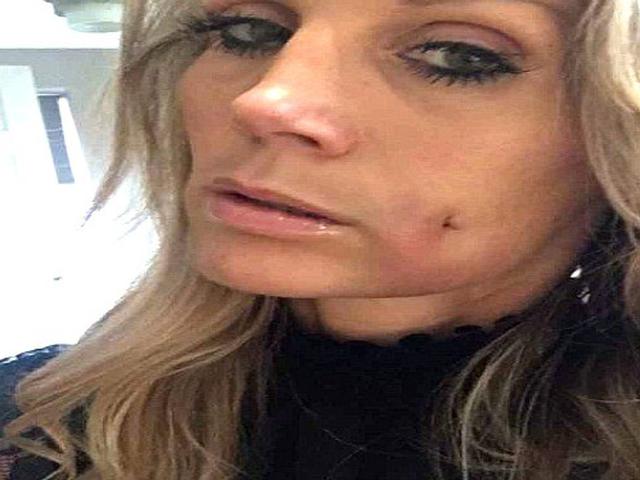 Iri Dengan Lesung Anak Ibu Ini Rela Bolongi Pipi Health Liputan6 Com