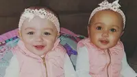 Kalani dan Jarani Dean adalah bayi kembar biracial asal Quincy, Illinois, Amerika Serikat. (sumber: CNN)