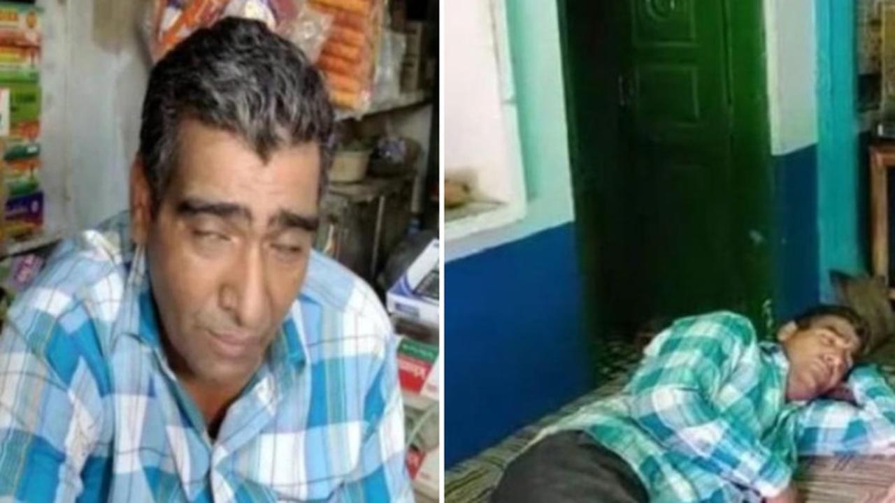 Punya Kondisi Langka, Pria Ini Tidur 300 Hari dalam Setahun