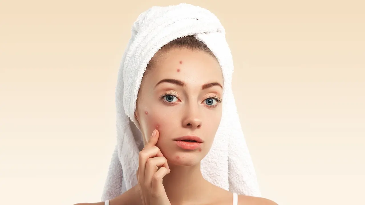 Pimple