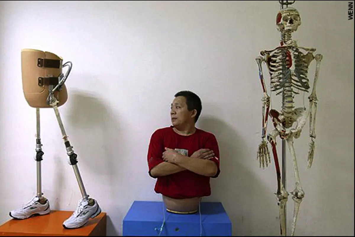 Peng Shuilin Pebisnis Sukses yang Kehilangan Setengah Tubuhnya