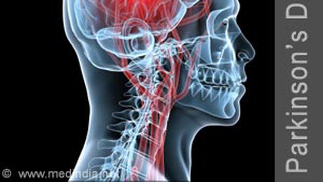 Parkinson Ganggu Saraf Dan Gerak Health Liputan6 Com