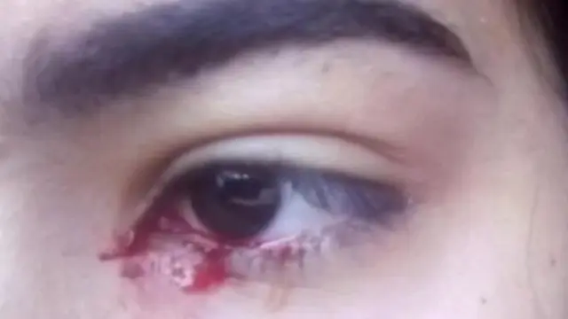 Dokter Dibuat Heran, Gadis 15 Tahun Keluarkan Darah Saat Menangis