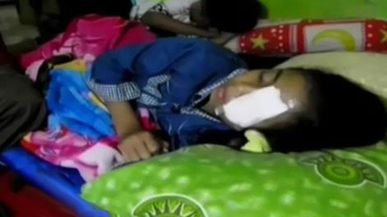 Buka Tutup Botol Soda, Mata Bocah Ini Nyaris Buta