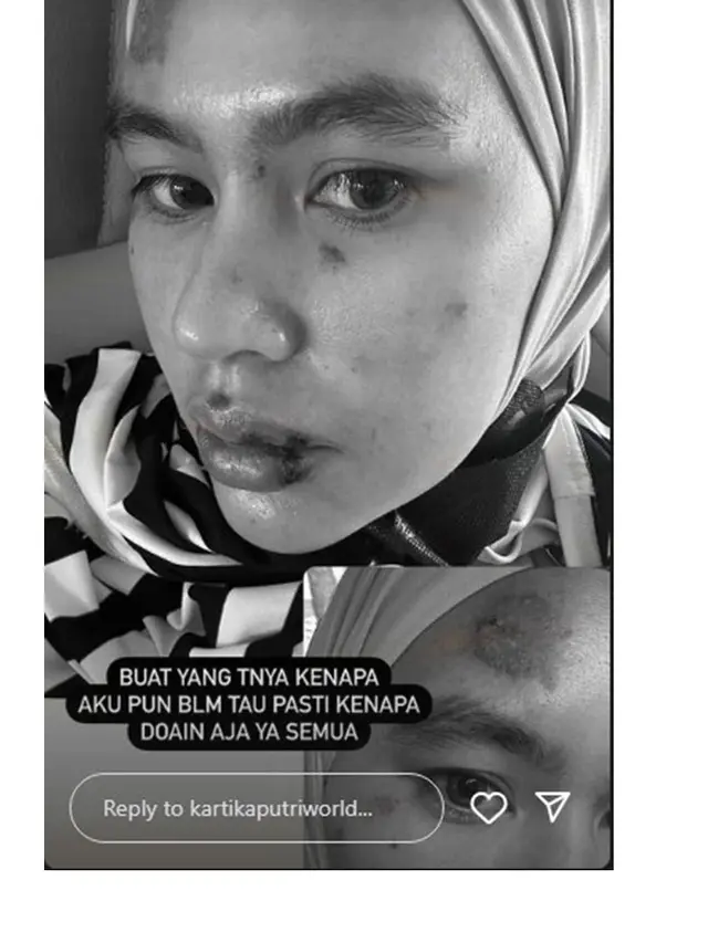7 Potret Kartika Putri Jalani Pengobatan di Singapura, Ungkap Idap Penyakit Misterius