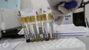 Sejumlah tabung bertuliskan nama pasien siap dimasukan ke dalam mesin pemutaran darah laboratorium kesehatan, Rumah Sakit Husada, Jakarta, Rabu (08/2). (Fery Pradolo/Liputan6.com)