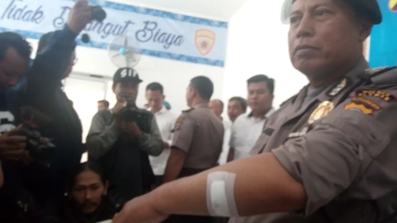 Aiptu Al Munir menunjukan bekas luka sabetan pelaku penyerangan Gereja Lidwina (Liputan6.com/Yanuar)