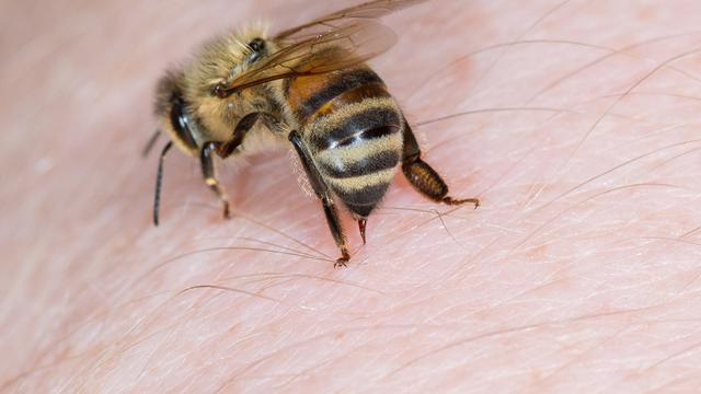 Pertolongan Pertama saat Disengat Lebah Jangan Anggap 