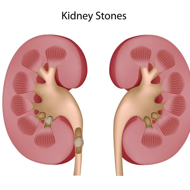 Download 770 Koleksi Gambar Ginjal Sepasang Paling Baru Gratis HD
