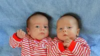Sebelum Tylan, Kenzie dikaruniai bayi kembar Samuel dan Alfie dari pasangan Rebecca (27) dan Vikki Lomax (23) yang lahir dua bulan silam. (www.dailymail.co.uk)