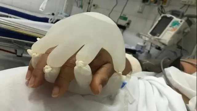 Perawat Ini Bikin Sarung Tangan Hangat untuk Pasien ICU, Kisahnya Bikin Haru