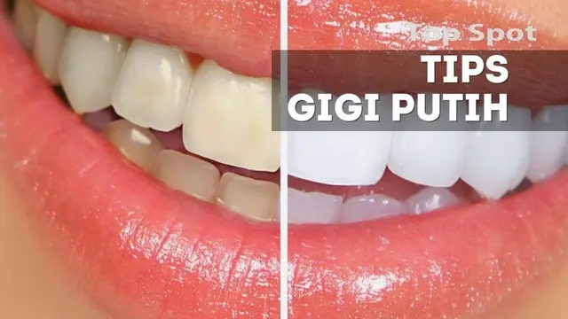 Tak perlu mengeluarkan kocek yang tebal, bahan alami ini bisa membuat gigi anda lebih putih dan prima.