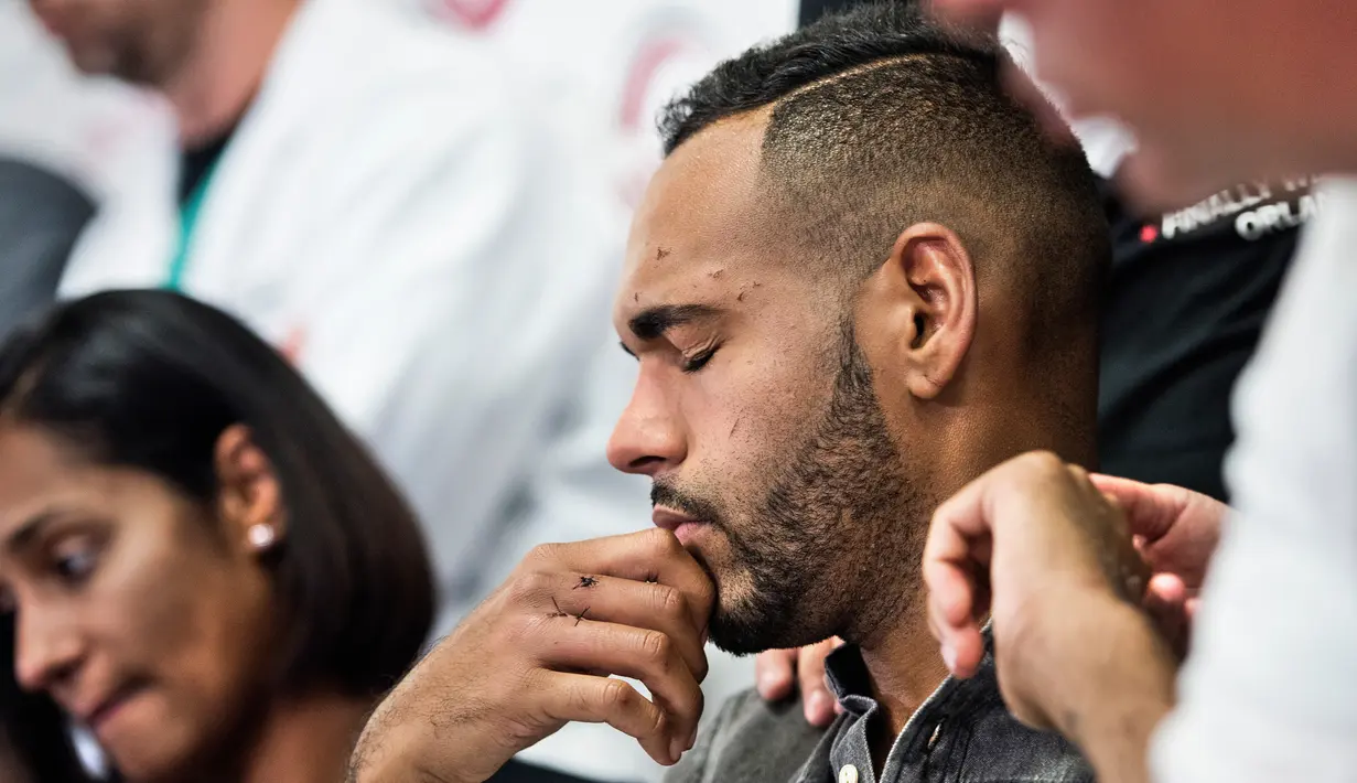 Angel Colon menutup matanya ketika menceritakan pengalaman saat penembakan brutal Orlando, pada konferensi pers di Orlando Regional Medical Center, Florida, Selasa (14/6). Colon tertembak di bagian lengan, tangan dan pinggul. (Brendan Smialowski/AFP)