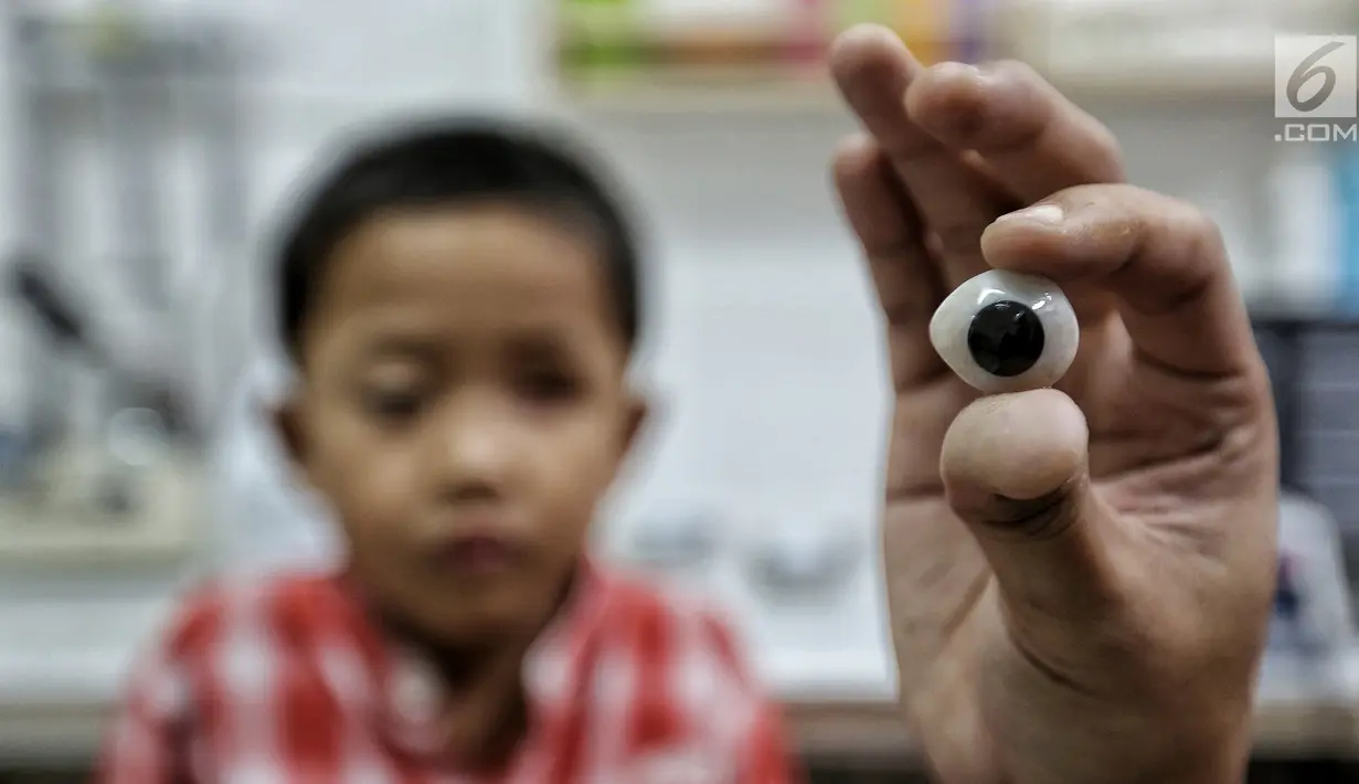 Sebuah bola mata palsu ditunjukkan sebelum dipasang di mata pasien anak di Klinik Ilyarsi Okularis, Villa Bintaro Indah, Tangsel, Selasa (15/5). Pembagian 23 mata palsu gratis merupakan donasi dari 8 anak perusahaan BUMN. (Liputan6.com/Fery Pradolo)