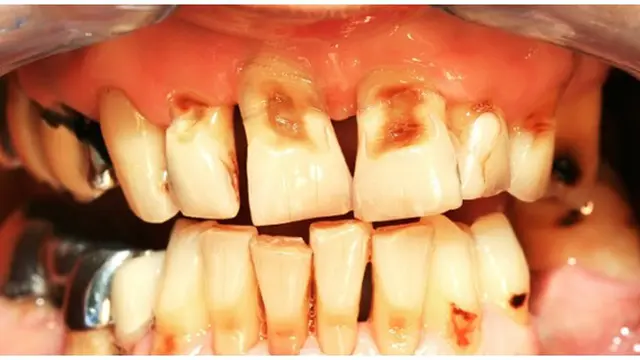 Foto : copyright listverse.com