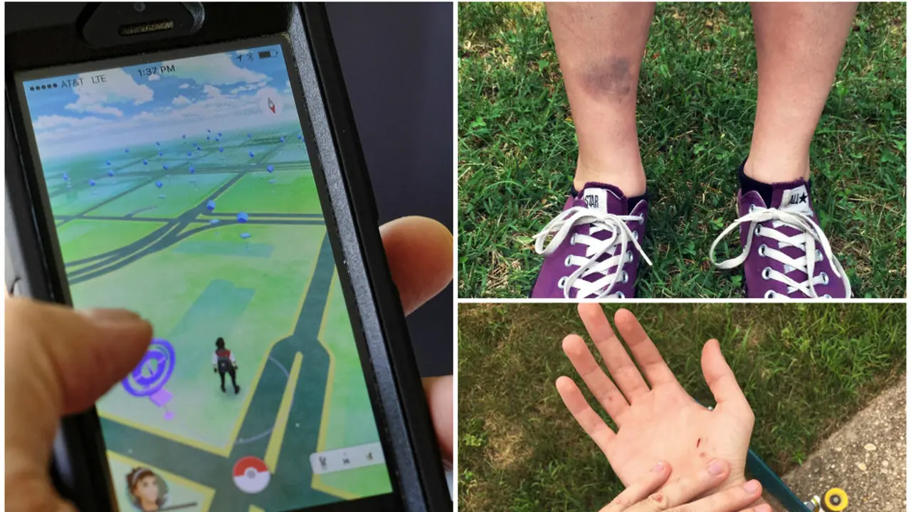 Mulai dari jatuh ke parit hingga hampir menabrak tiang listrik pernah dirasakan oleh beberapa dari mereka yang sudah bermain Pokemon Go. (Foto: NY Post)