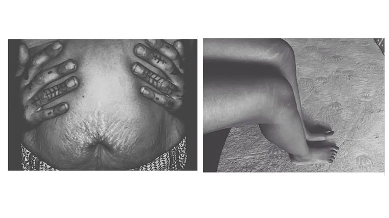 Upload Stretch Mark di Instagram, Malukah?
