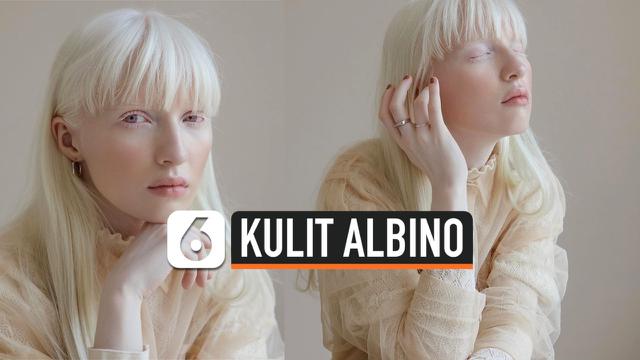 Berita Albino Hari Ini Kabar Terbaru Terkini Liputan6 Com