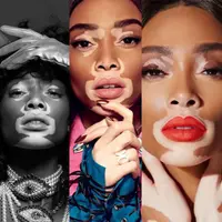 Winnie Harlow hingga Carmen Dell'Orefice, sejumlah perempuan cantik yang tampil berbeda dengan cara mereka tersendiri. (Foto: Instagram/ @WinnieHarlow)