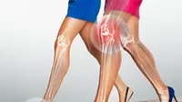 Kerusakan pada otot kaki dan telapak kaki (Via: linkedin.com)
