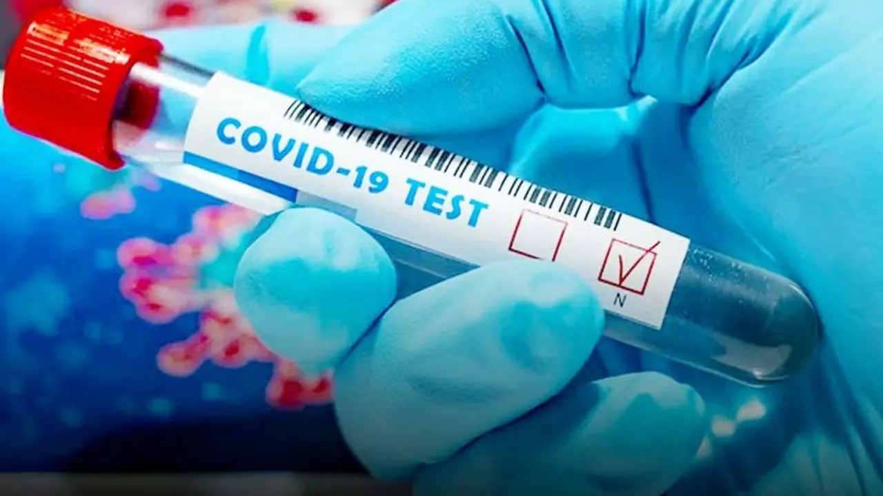 Istri dan Menantu Gubernur Maluku Utara Positif Covid-19