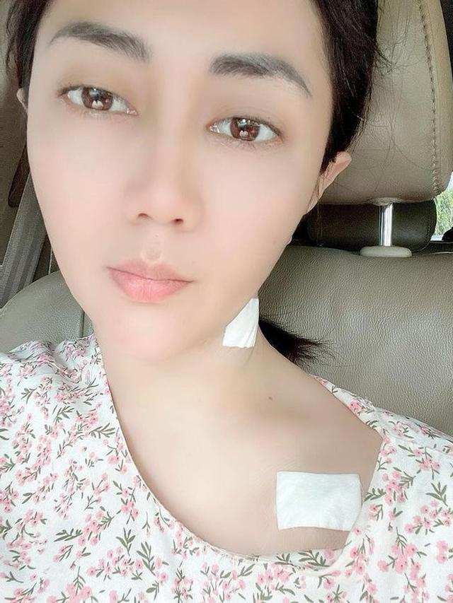 Sempat Prank Bunuh Diri, Ini 7 Potret Terbaru Aida Saskia Berjuang Lawan Kanker