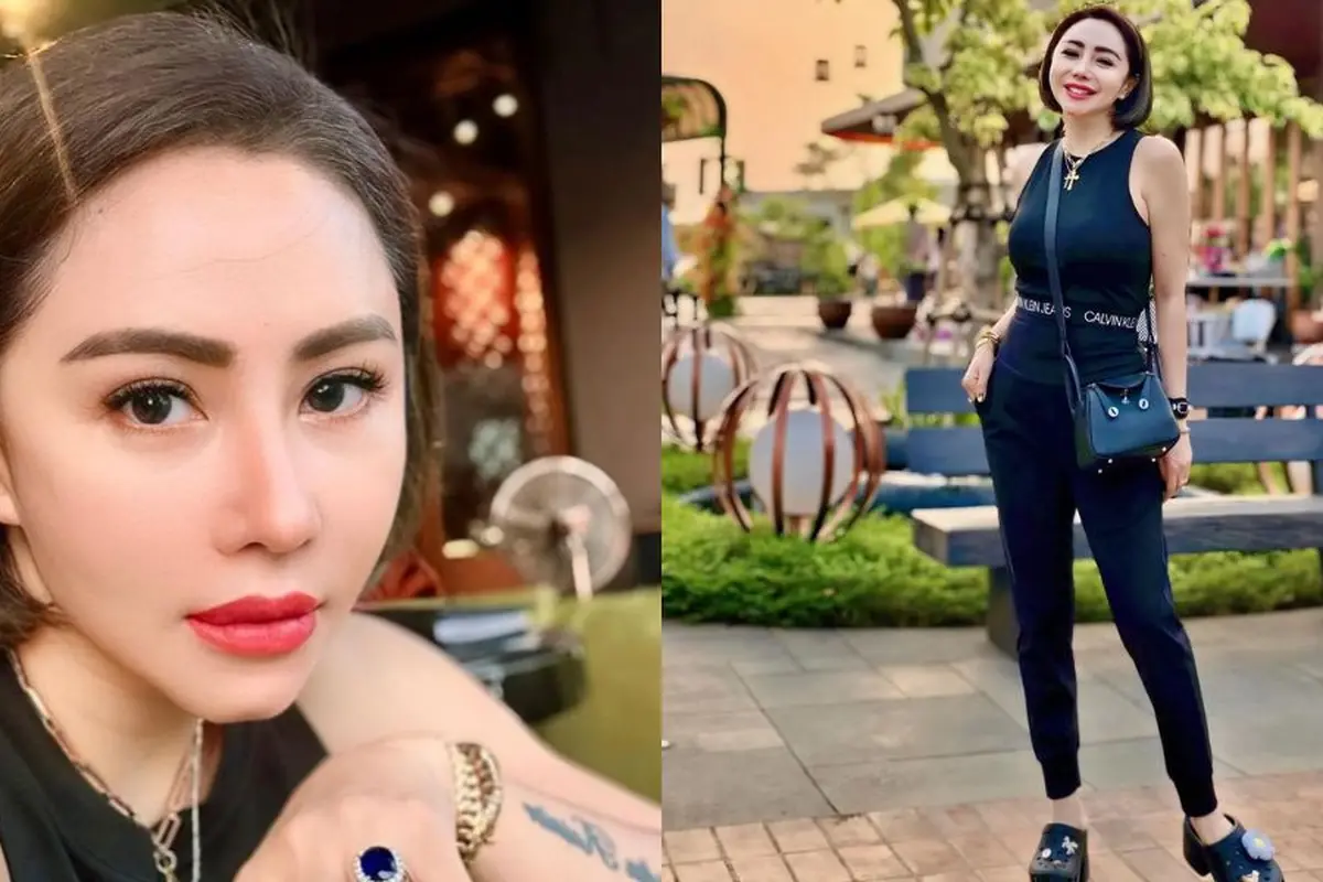 Kisah Mengharukan Femmy Permatasari yang Pernah Koma Hingga Amnesia dan Tidak Mengenali Orang