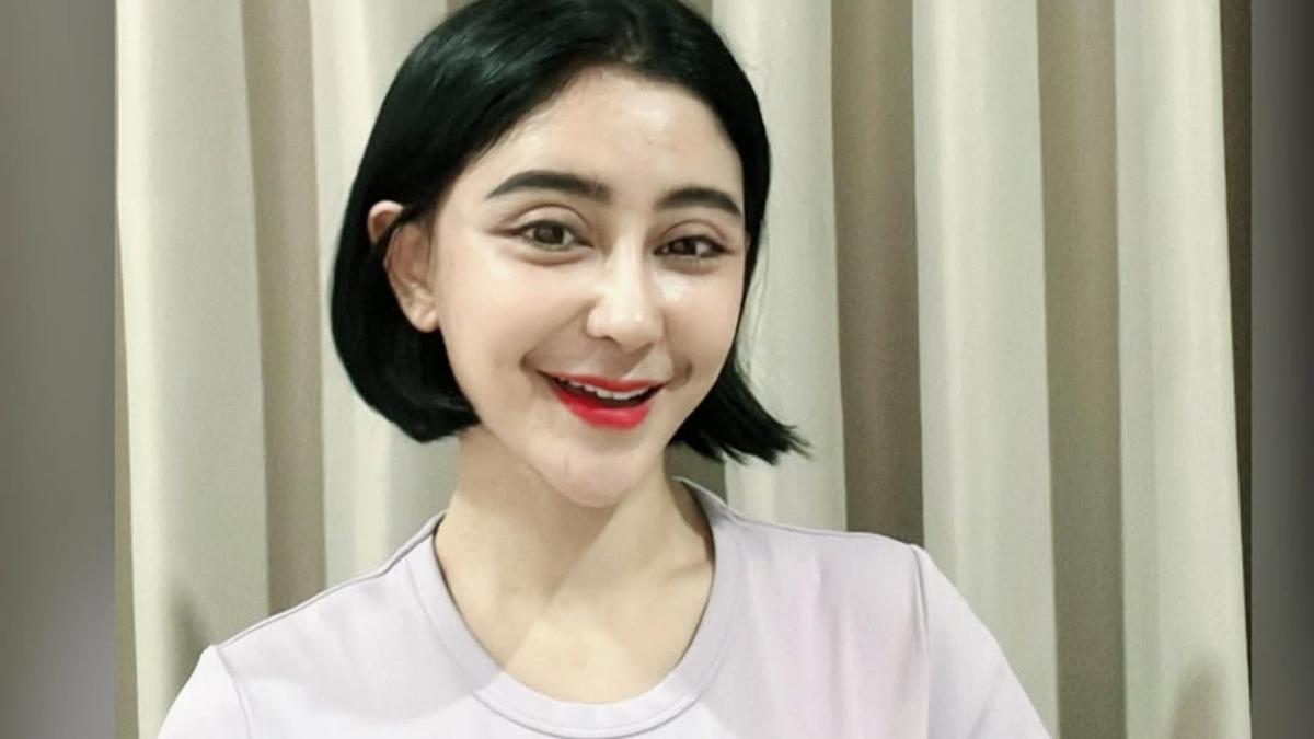 Uut Permatasari Oplas di Korea Selatan, Lakukan Facelift sampai Bedah Hidung