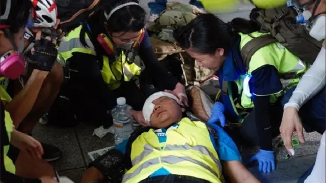 Jurnalis asal Indonesia Veby Mega Indah tertembak peluru karet saat meliput unjuk rasa di Hong Kong pada Minggu 29 September. (Twitter/@yukisuet1)