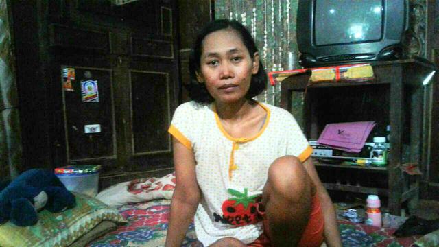 Lutut Kanan Ibu 4 Anak Terus Bengkak Usai Demam Regional