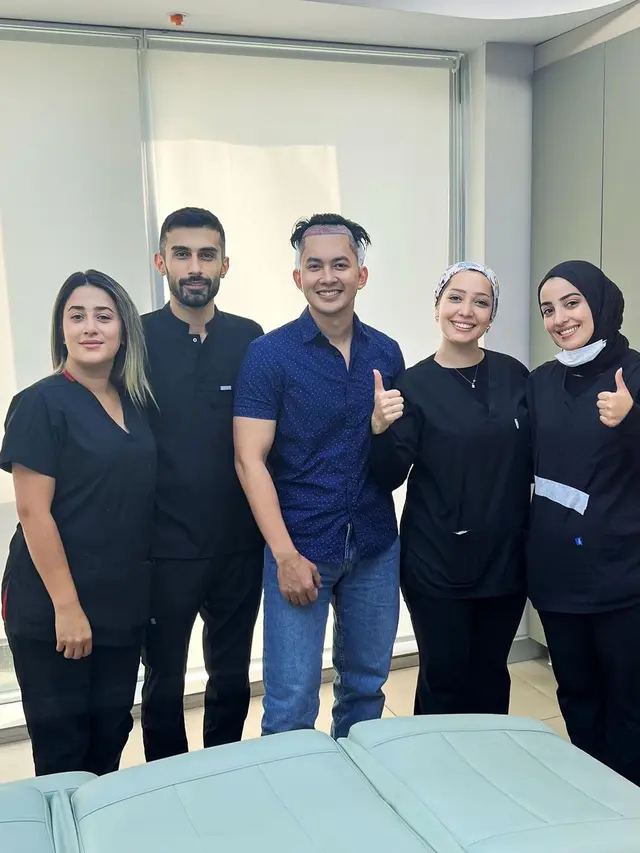 7 Potret Kiki Farel Transplantasi Rambut, Seru Nikmati Liburan Sebelum Operasi