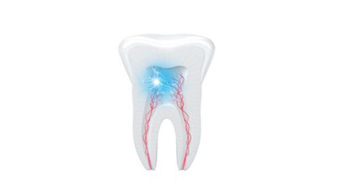 Ilustrasi gigi sensitif