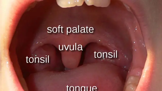 Uvula