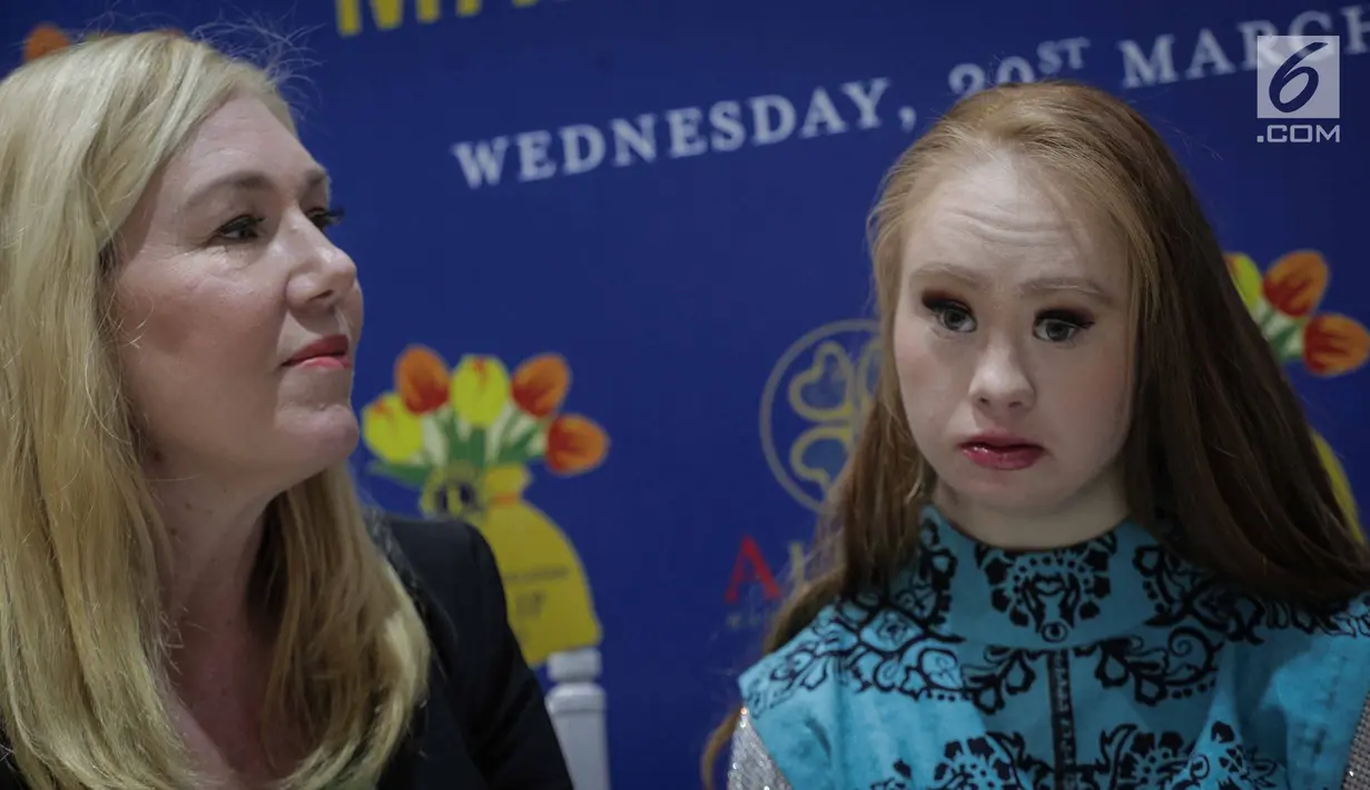Model Madeline Stuart didampingi Ibunya Rosanne saat diwawancarai Liputan6.com di Alleira Batik Plaza Indonesia, Jakarta, Rabu (20/3). Madeline adalah model penderita down syndrome pertama asal Australia. (Liputan6.com/Faizal Fanani)