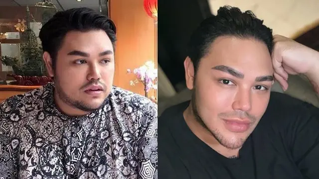 Termasuk Deddy Corbuzier, Perubahan Dagu 5 Artis Pria Ini Juga Jadi Sorotan