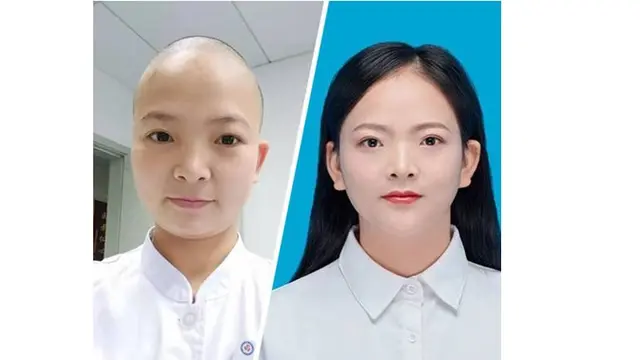 Wanita Ini Rela Botak Demi Kelancaran Pekerjaan, Alasannya Bikin Haru