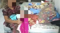 Bayi Tanpa Anus di Probolinggo Butuh Bantuan