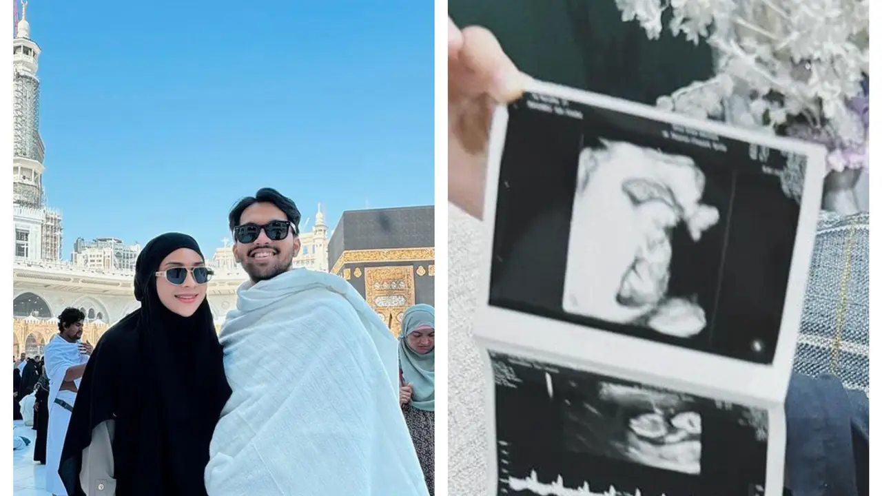 Selebgram Ira Nandha Umumkan Hamil Anak Kedua Usai Rujuk dengan Elmer