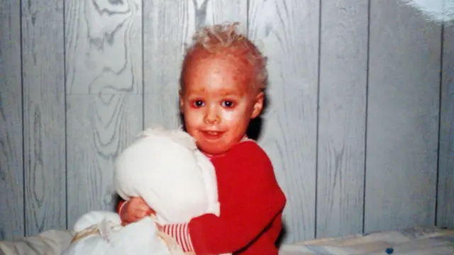 [Bintang] 5 Potret Gadis Bersisik yang Kini Jadi Ratu Kecantikan